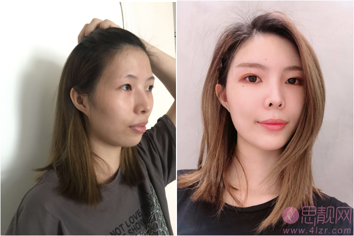 北京联合丽格第一医疗美容医院
