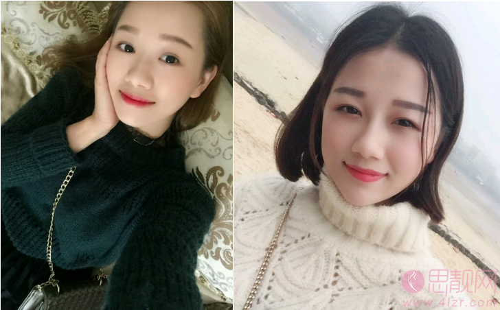北京航天总医院整形
