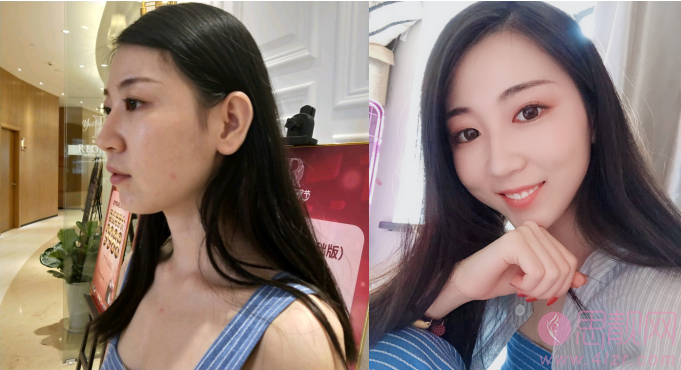 北京友谊医院整形