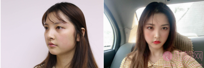 北京大学人民医院整形美容科