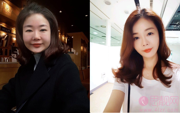 北京大学人民医院整形美容科