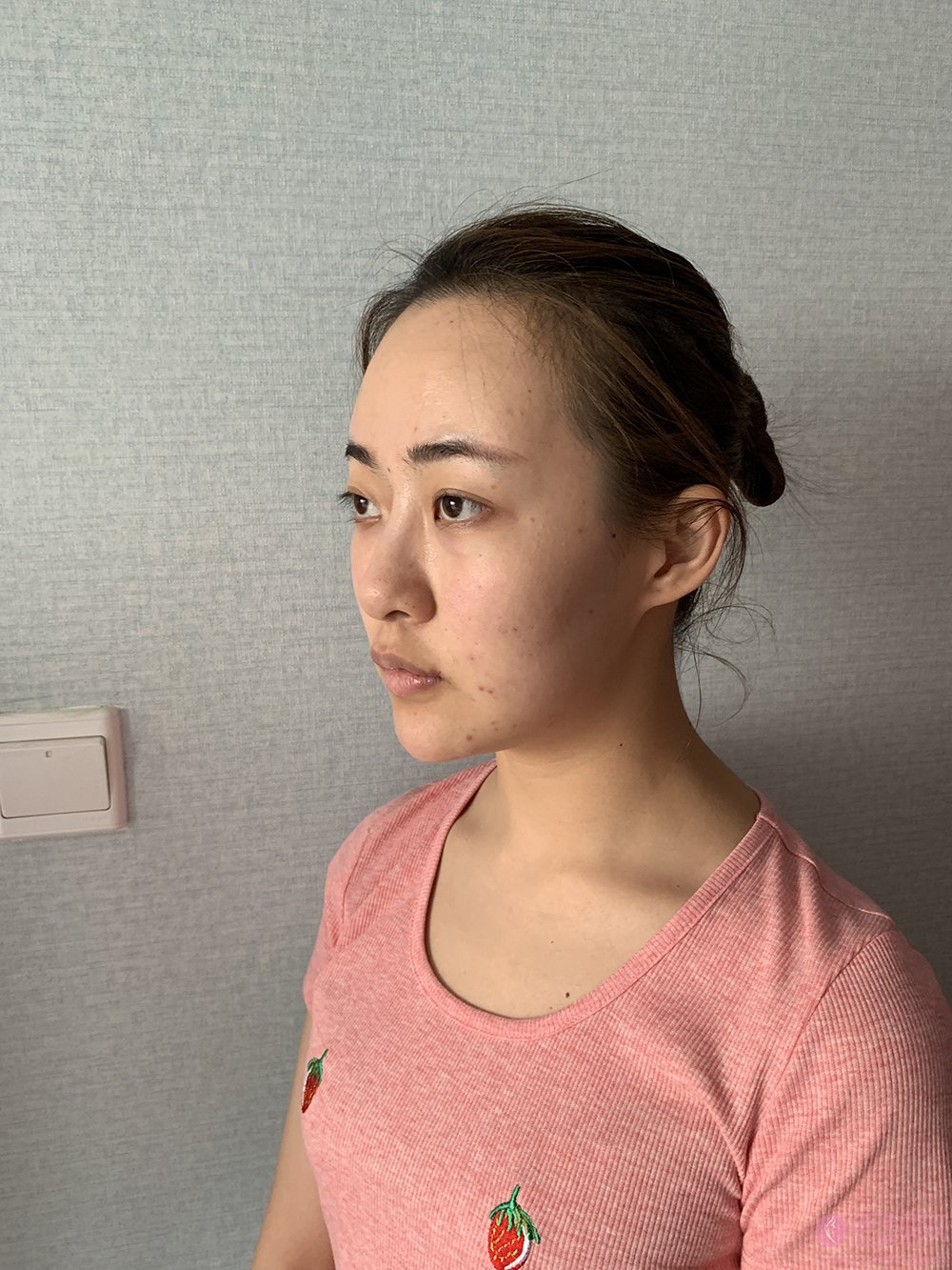 西安美立方美容医院怎么样?附隆鼻案例及2020年价格表发布