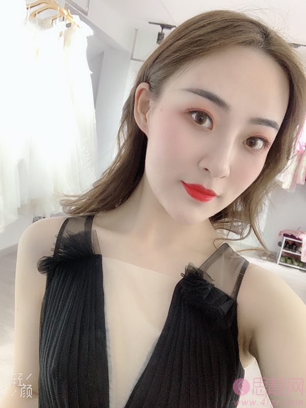 西安美立方美容医院怎么样?附隆鼻案例及2020年价格表发布