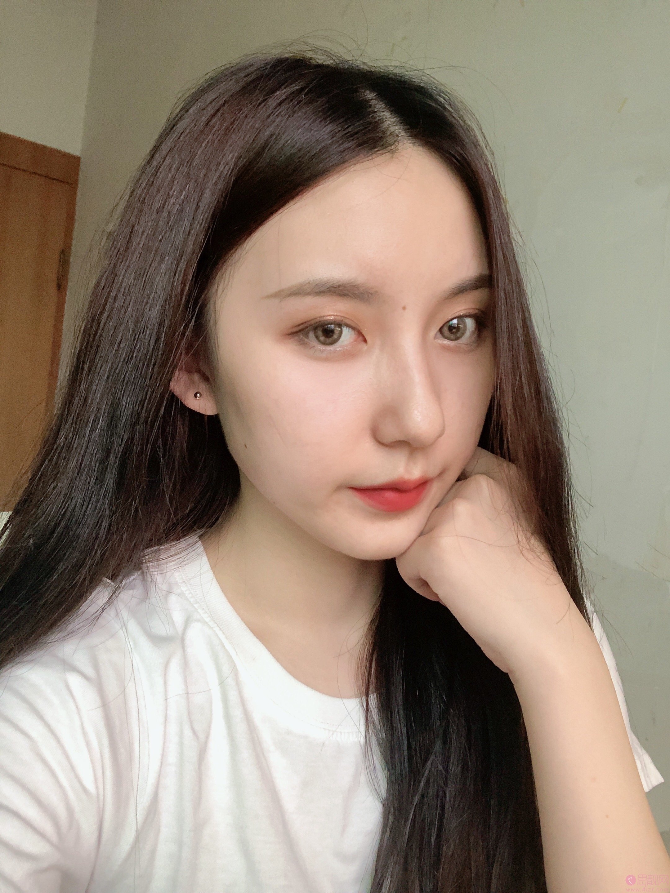 上海映九医疗美容隆鼻怎么样?附隆鼻真实案例展示及2020年价格表发布