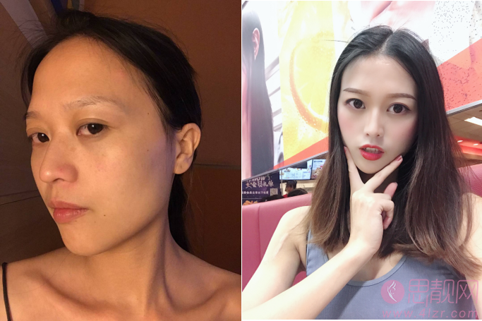 上海仁济医院整形美容科