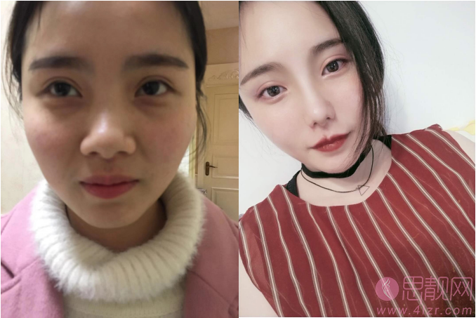 浙大附二院整形美容科