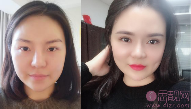 成都美未央医疗美容