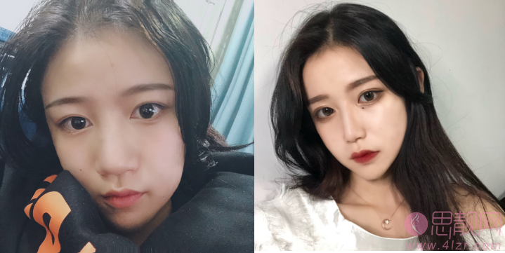 成都美绽美整形美容医院