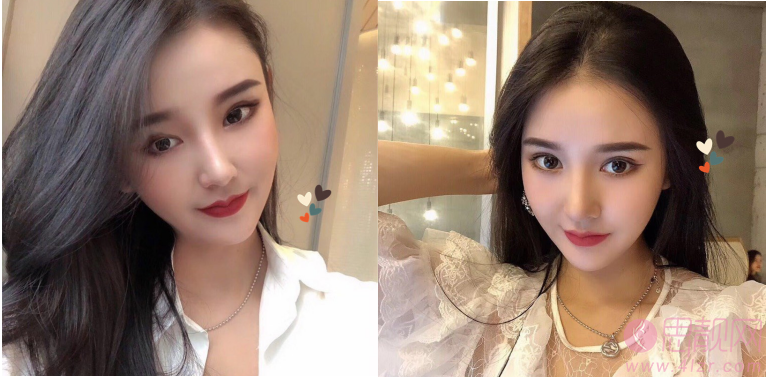成都美绽美整形美容医院