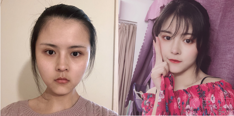 成都丝缘植发