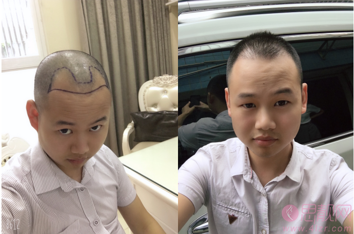 成都丝缘植发
