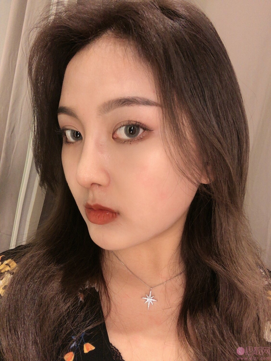 成都蜀尚荣雅美容整形医院隆鼻怎么样?附隆鼻真人案例反馈+2020价格表发布