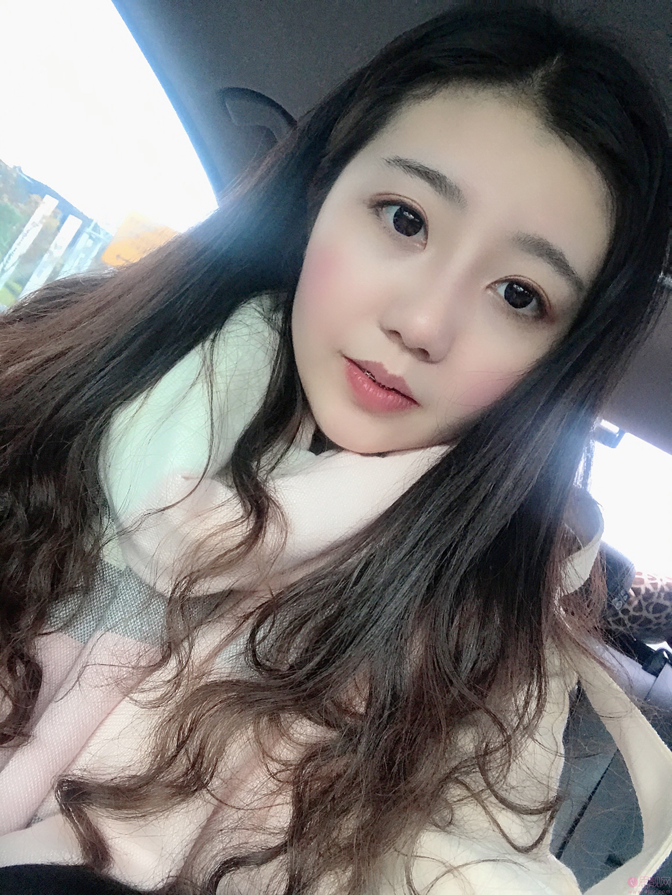 佛山华美整形医疗美容医院雷朝勇隆鼻怎么样？附隆鼻案例及2020年价格表一览