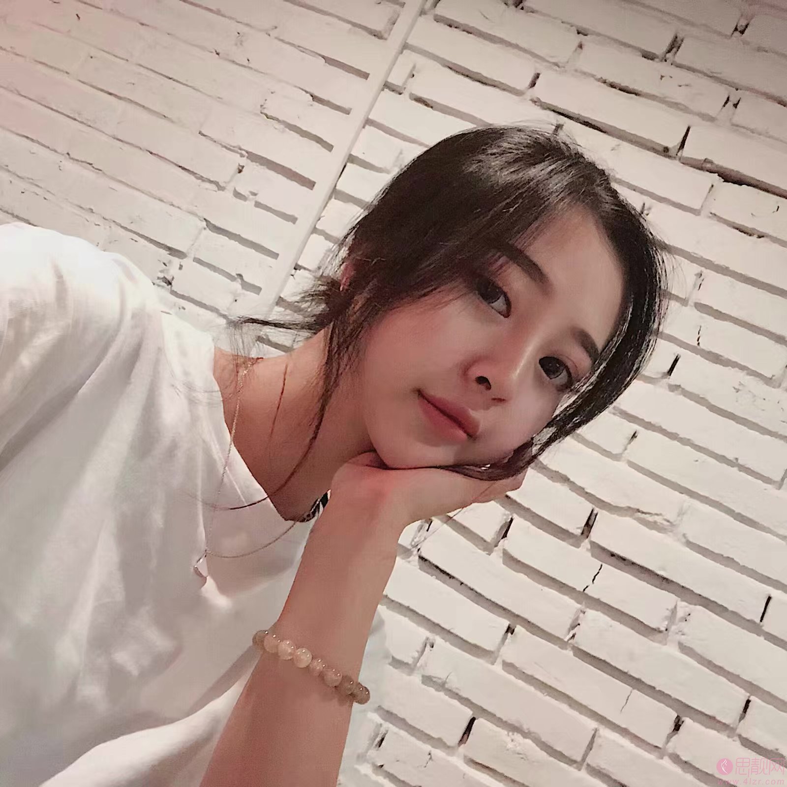 合肥亚典美容医院陈录翔隆鼻怎么样？附隆鼻案例及2020年价格表一览