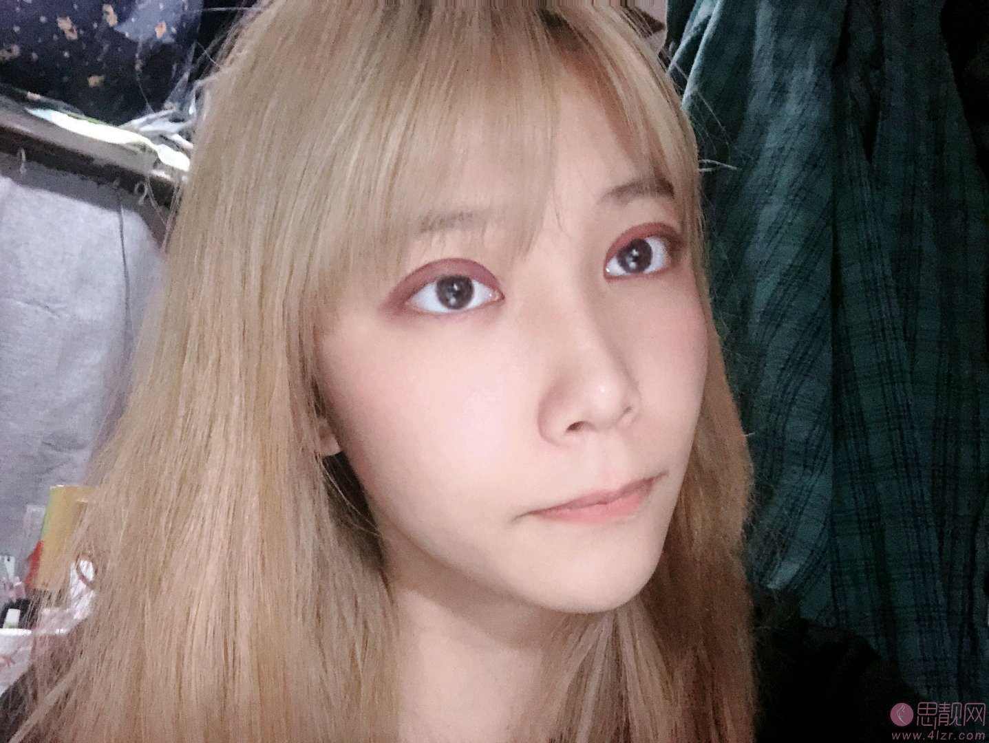 乌鲁木齐伊丽莎白整形医院怎么样？附双眼皮案例及2020年价格表发布