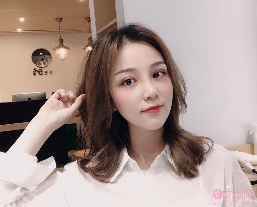 重庆联合丽格美容医院樊雯君医生做双眼皮好不好？附双眼皮真人案例及2020年价格表曝光