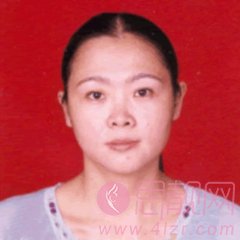 安徽医科大学附属医院整形美容中心李小静医生做双眼皮咋样？