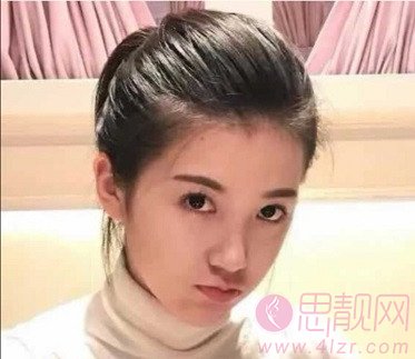 上海九院的光子嫩肤效果好吗?附案例分享+2020年价格表发布