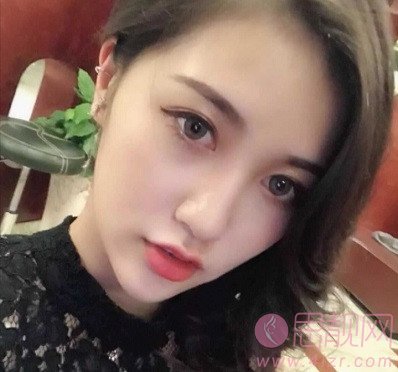 上海九院的光子嫩肤效果好吗?附案例分享+2020年价格表发布