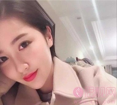 上海九院的光子嫩肤效果好吗?附案例分享+2020年价格表发布