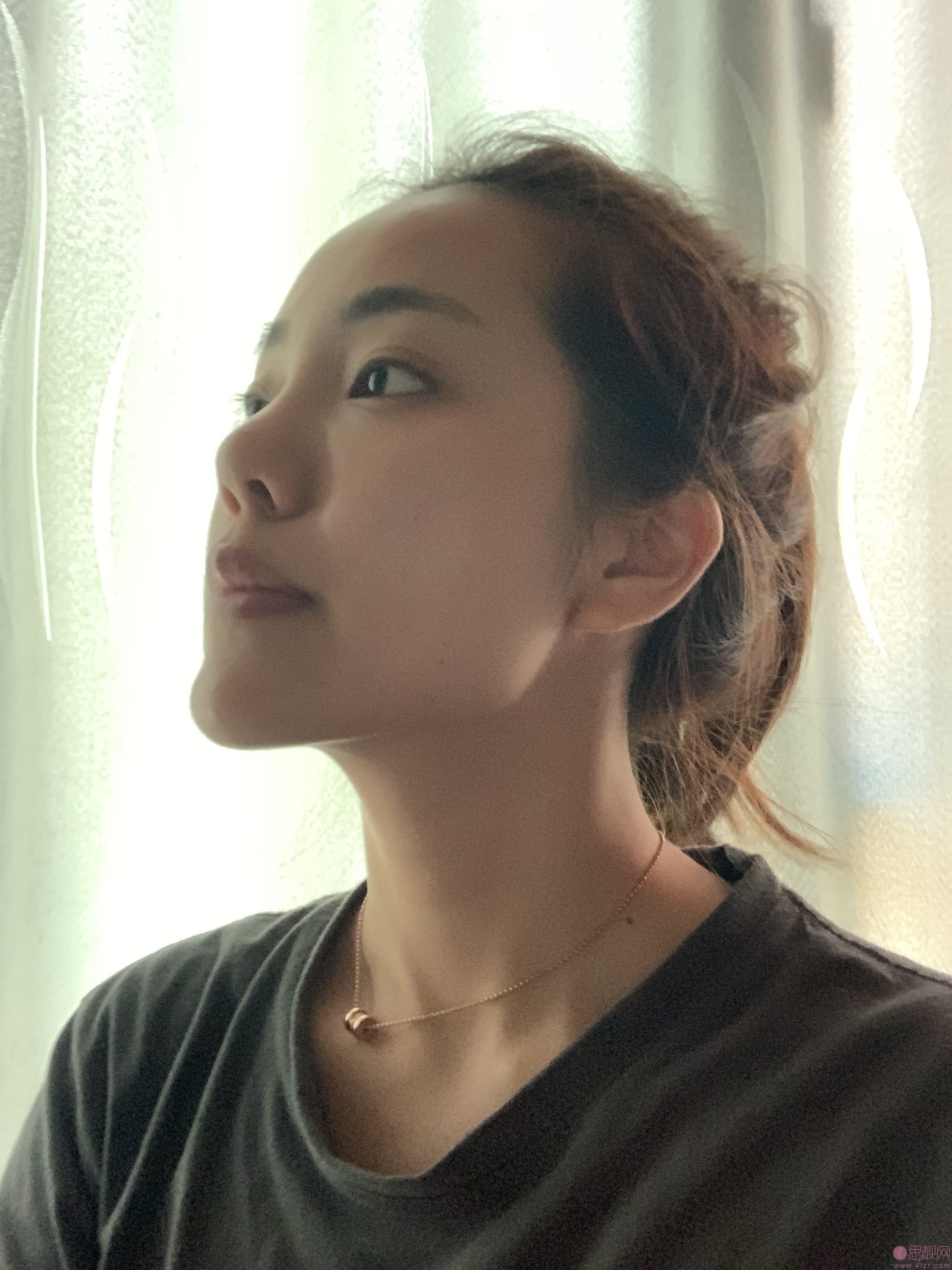 上海美莱医疗美容祛斑怎么样?附真人案例分享+2021年价格表发布