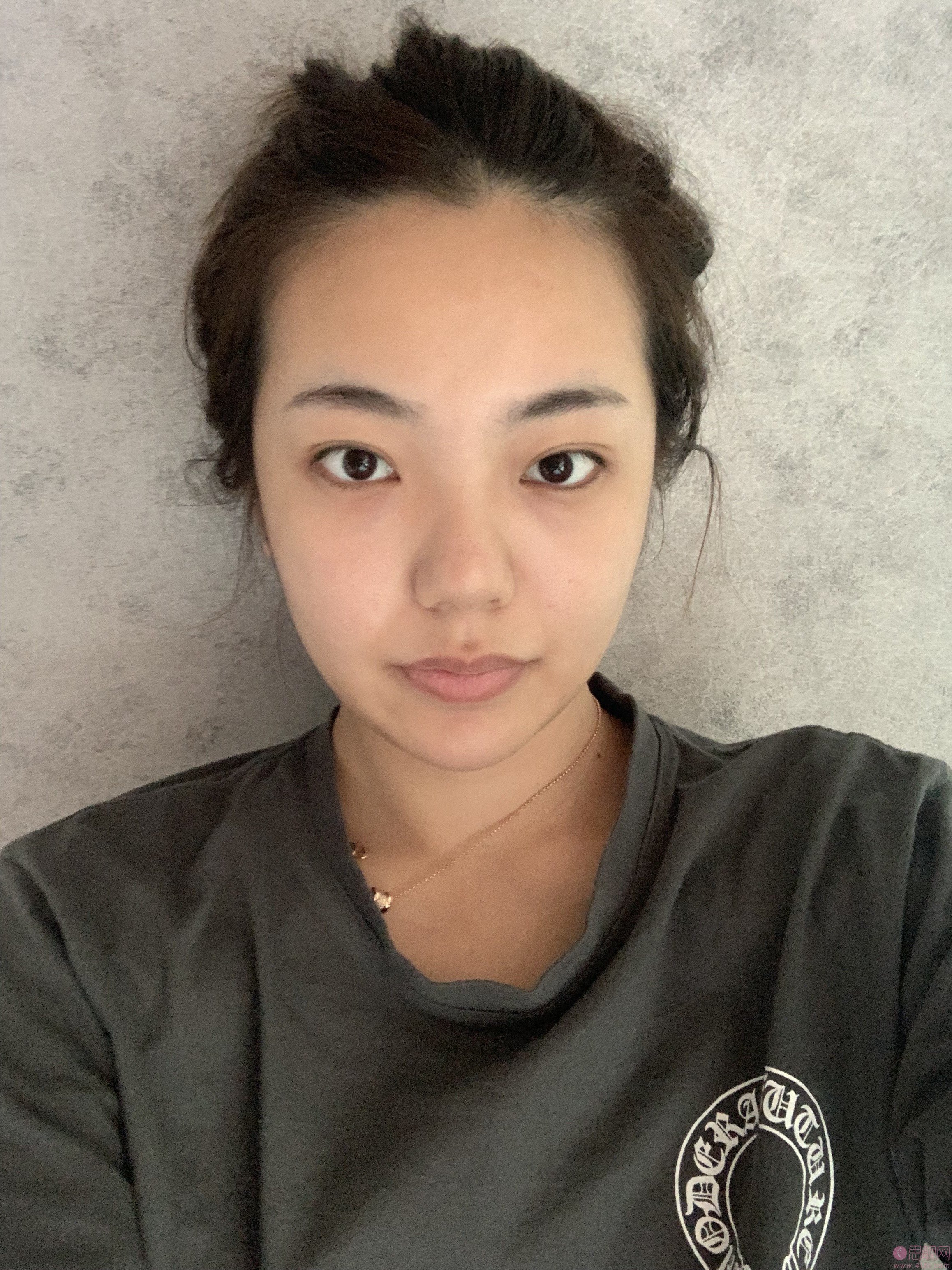 上海美莱医疗美容祛斑怎么样?附真人案例分享+2021年价格表发布