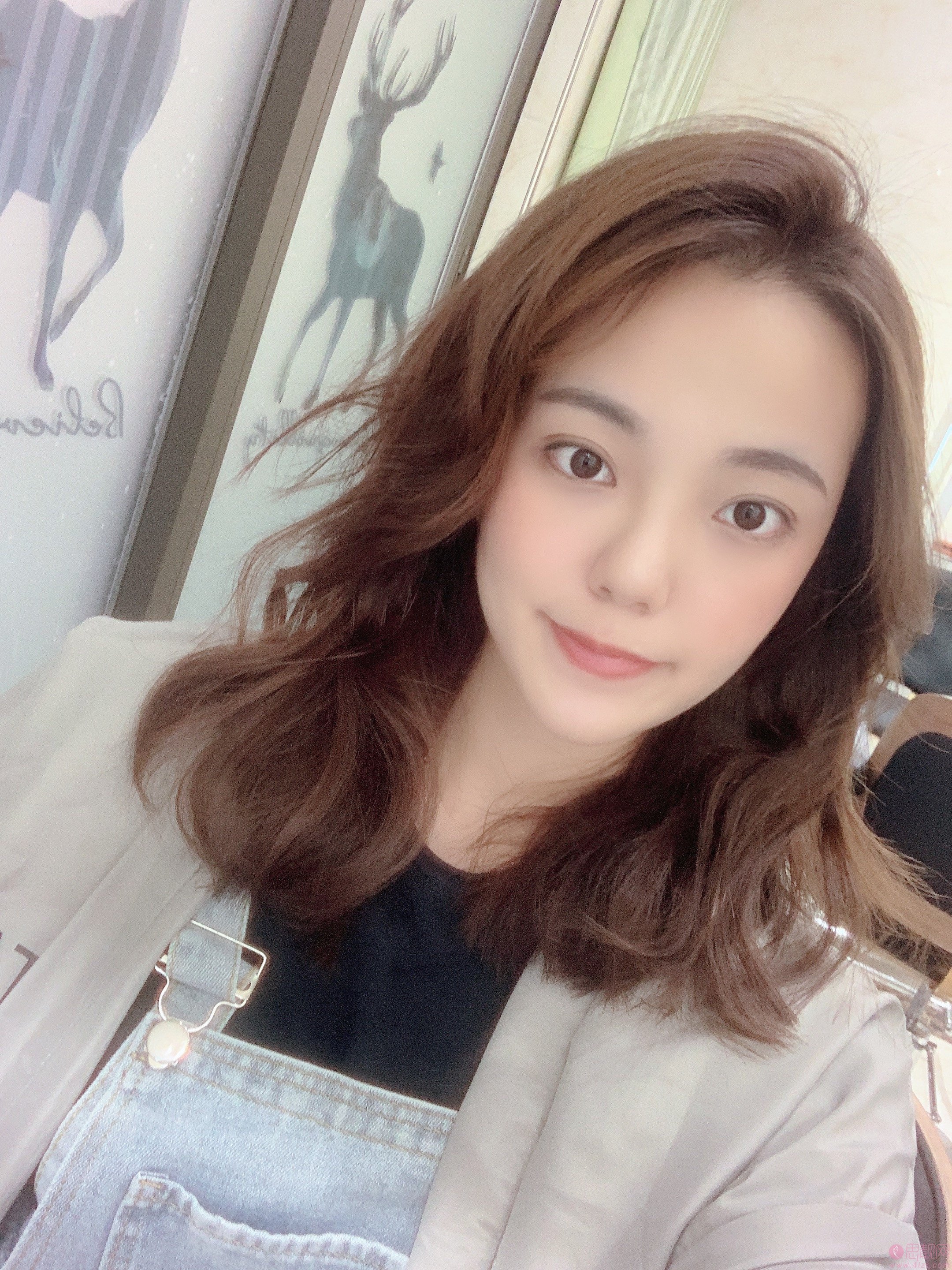 上海美莱医疗美容祛斑怎么样?附真人案例分享+2021年价格表发布