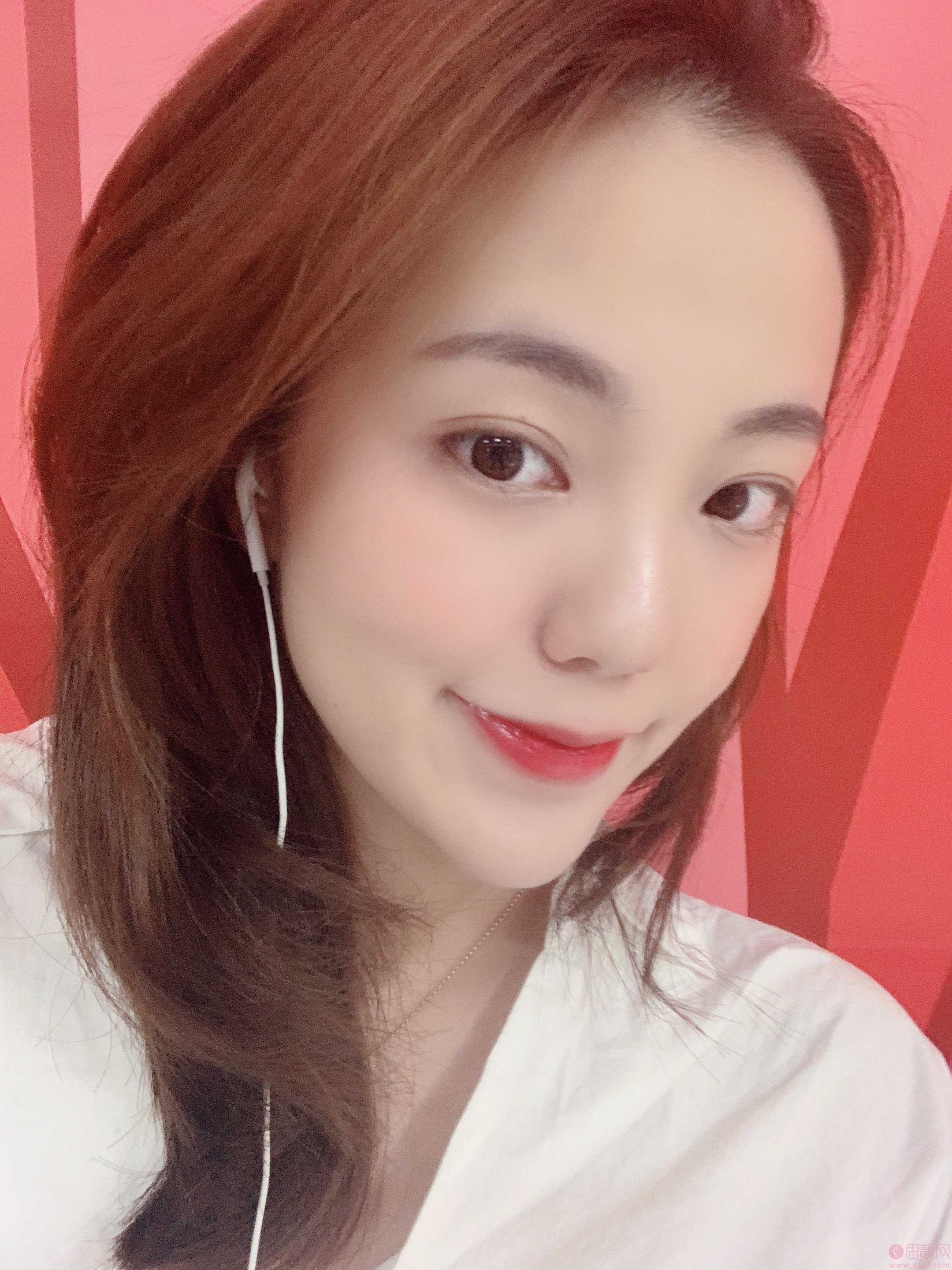 上海美莱医疗美容祛斑怎么样?附真人案例分享+2021年价格表发布