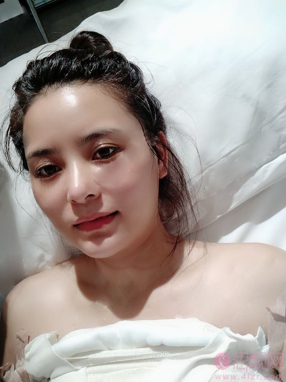 重庆华美整形美容医院陈德法隆胸怎么样?附案例及2021年价格表曝光