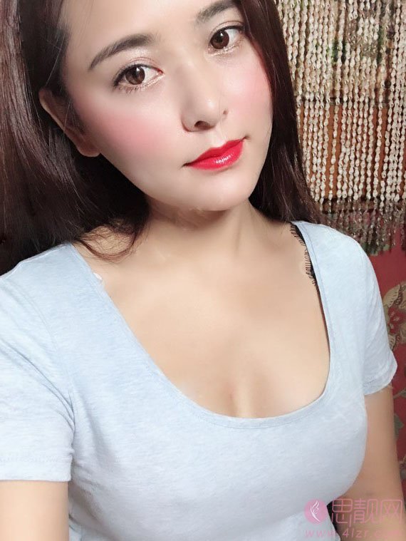 重庆华美整形美容医院陈德法隆胸怎么样?附案例及2021年价格表曝光