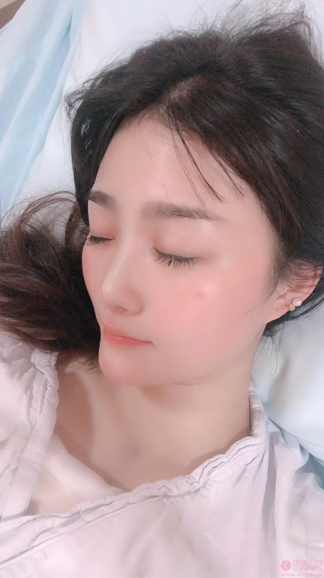 重庆华美整形美容医院陈德法隆胸怎么样？附案例及2021年价格表曝光