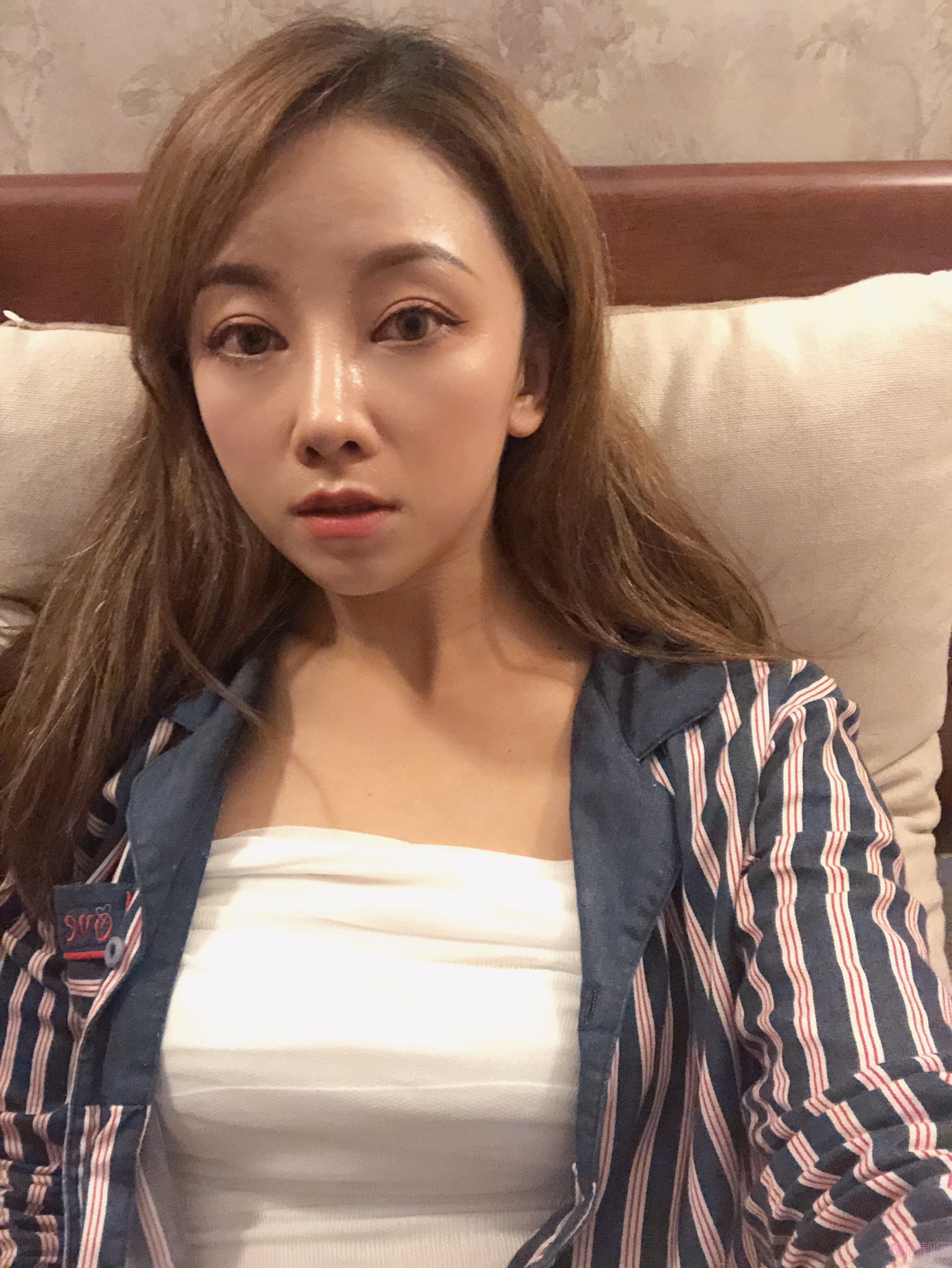 上海鹏爱医疗美容门诊部怎么样？附价格表曝光+丰胸案例分享