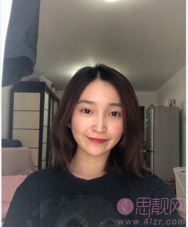 上海第九整形美容医院价格表+激光祛斑真人案例展示