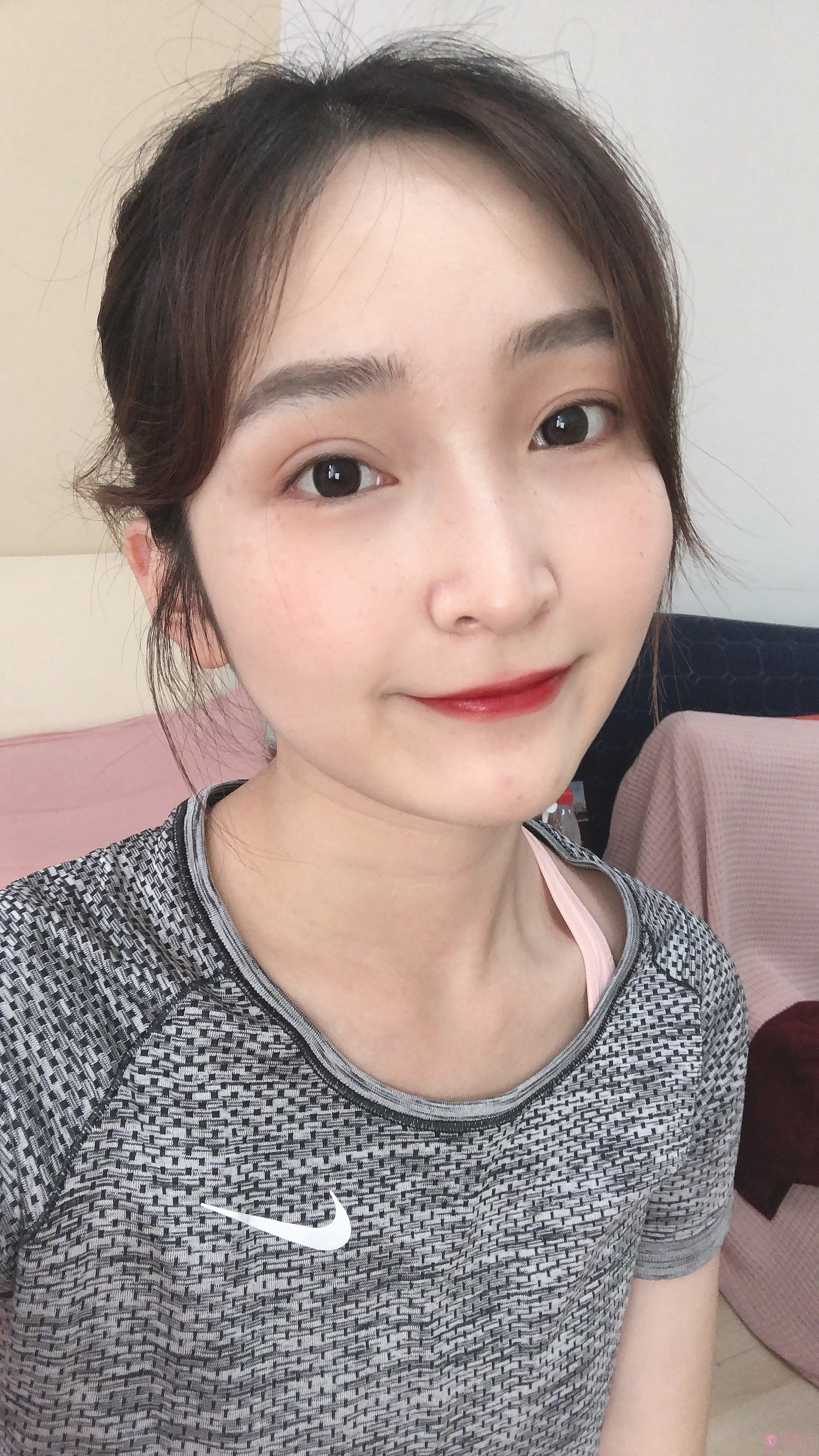 上海第九整形美容医院价格表+激光祛斑真人案例展示