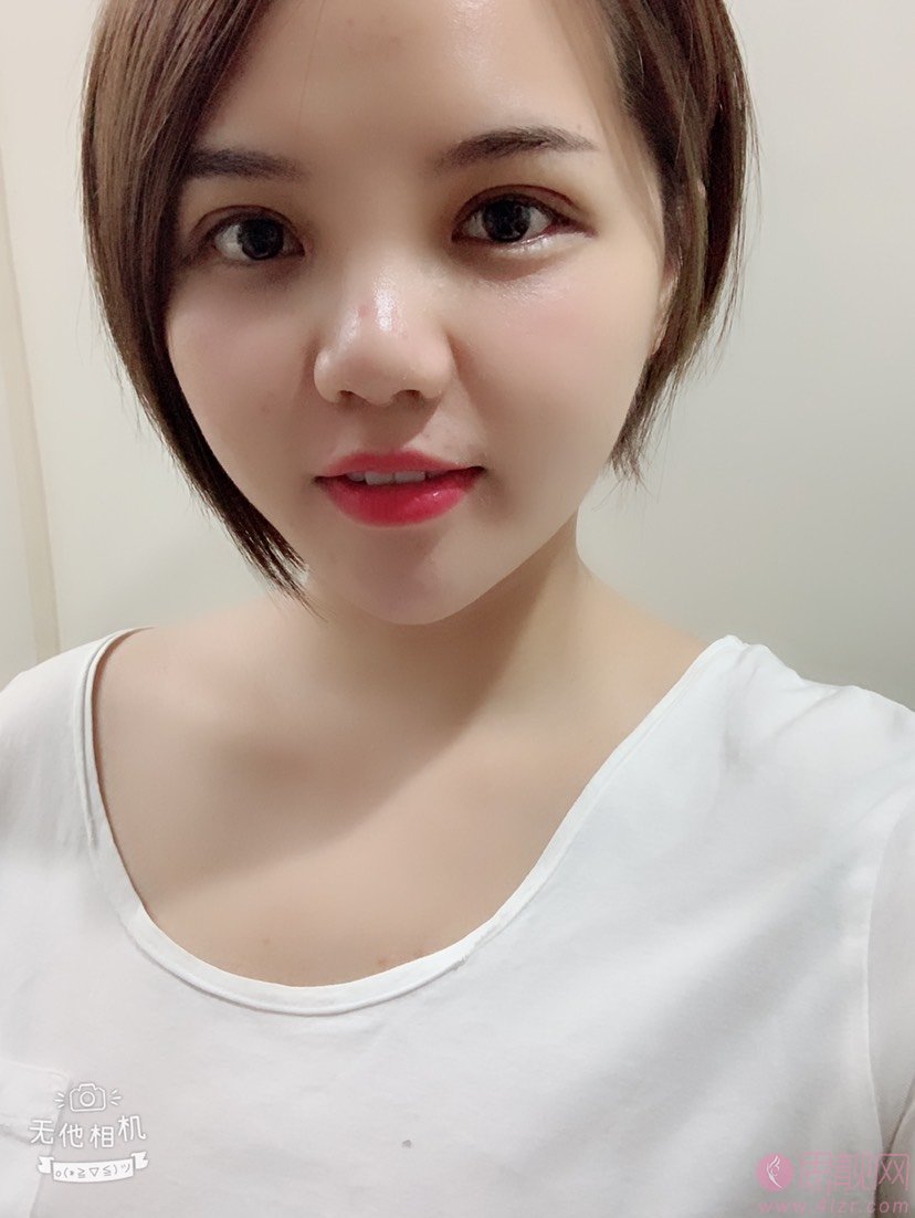 上海江依南医疗美容医院好不好?附2021年价格表发布+双眼皮案例分享