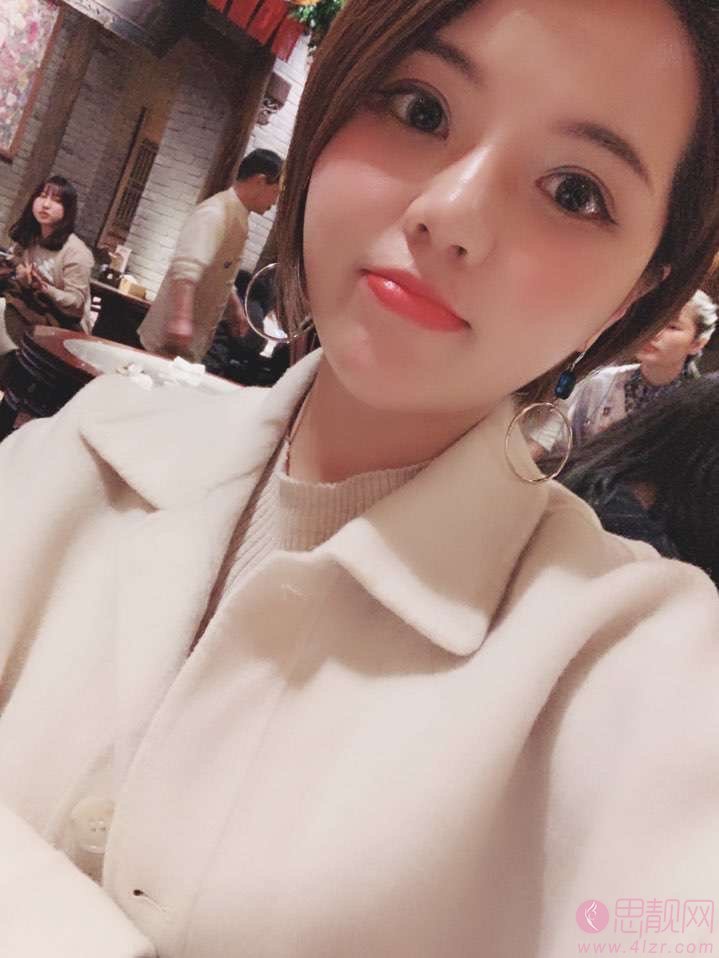 上海江依南医疗美容医院好不好?附2021年价格表发布+双眼皮案例分享