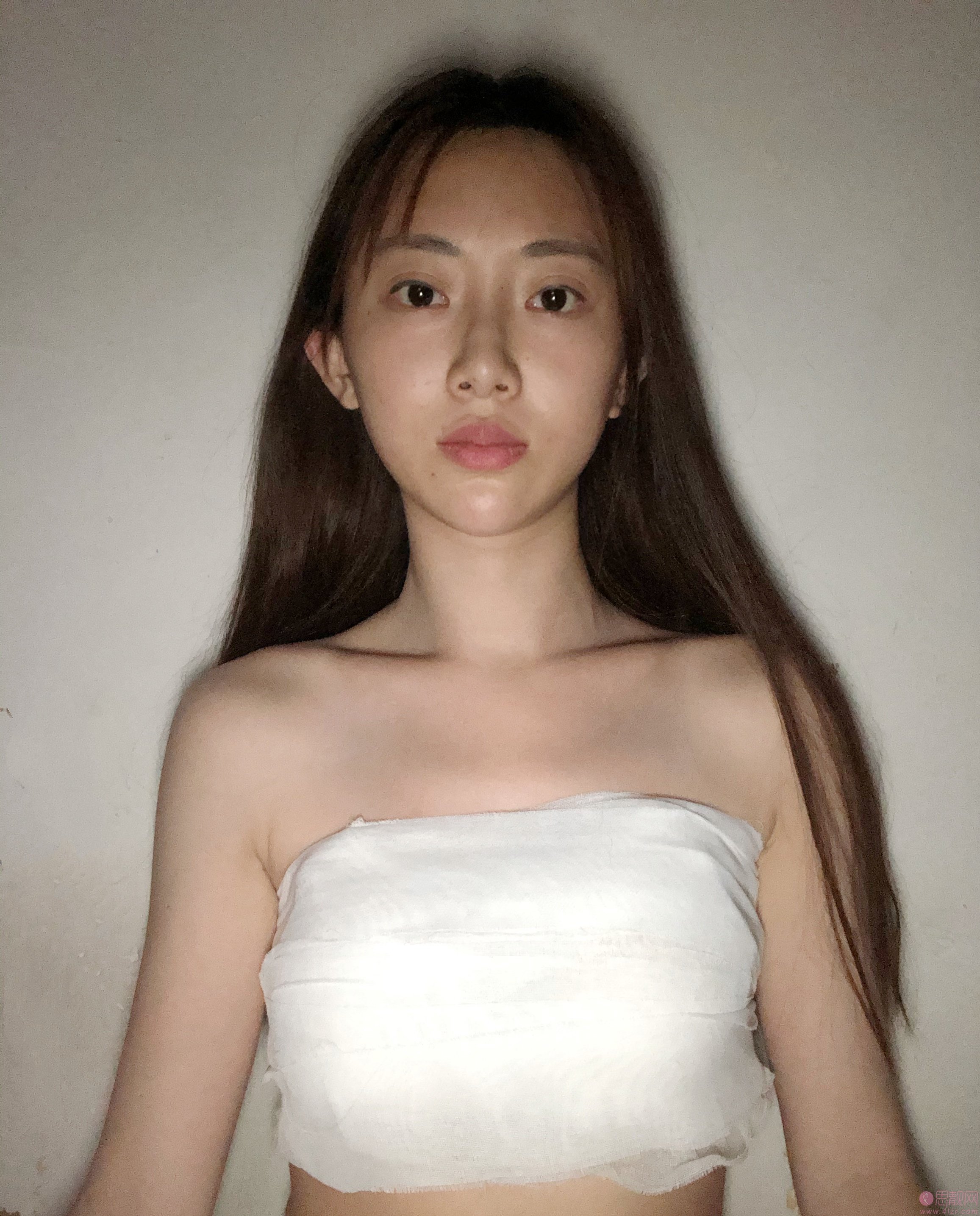 上海美立方医疗美容医院怎么样?附隆胸案例+2021年价格表明细一览