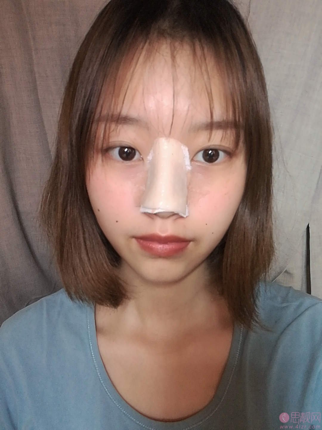 重庆当代整形黄鲜隆鼻好不好？附术后案例效果分享+2021年价格表曝光