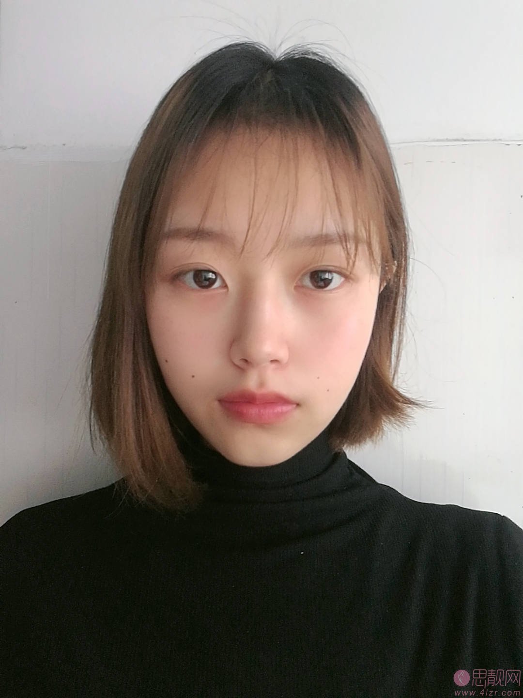 重庆当代整形黄鲜隆鼻好不好？附术后案例效果分享+2021年价格表曝光