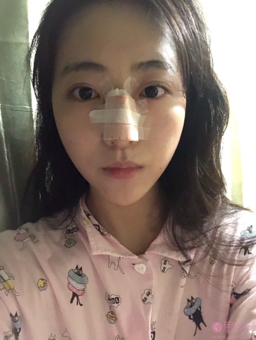 广州韩妃整形怎么样靠谱吗？附隆鼻案例及2021年价格表公开