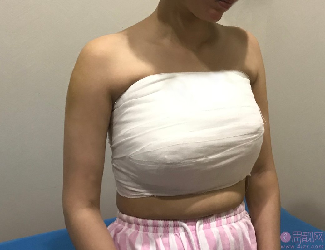 瑞美荟医疗美容薛瑞隆胸怎么样？附真人案例反馈及2021年价格表一览