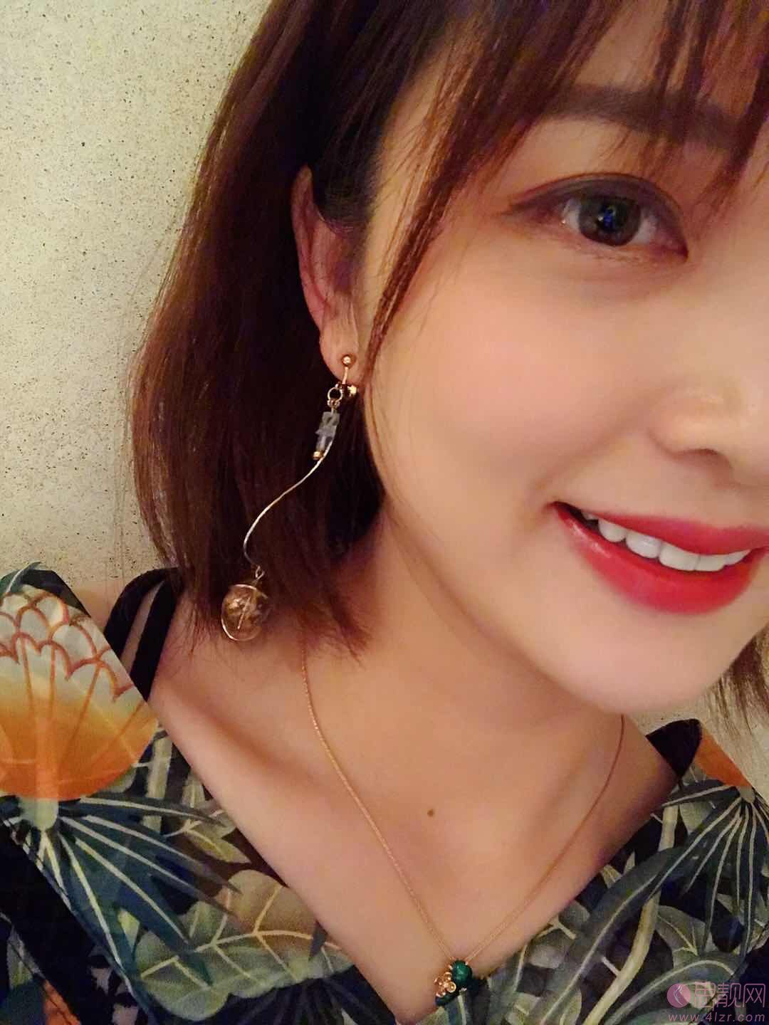 上海华尔康麦芽口腔门诊部美白牙齿怎么样?附案例及2021年价格表发布