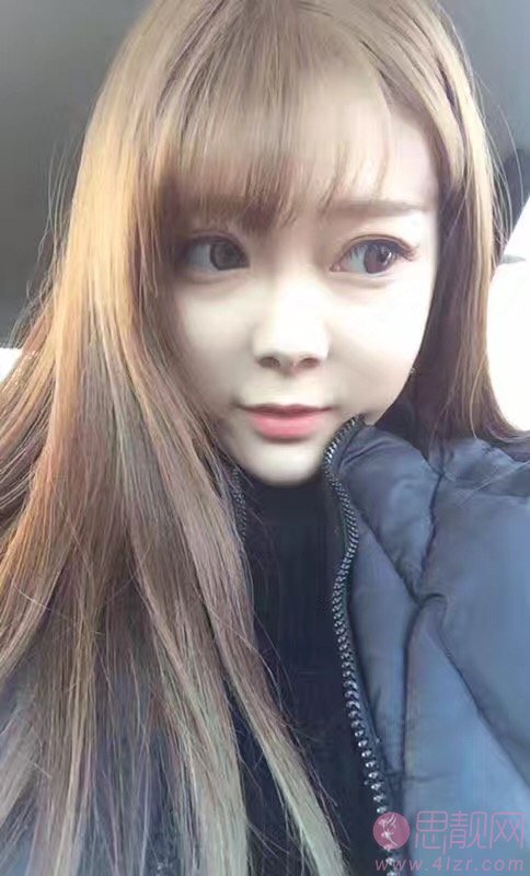 曾高医生做鼻子怎么样？附隆鼻案例分享+2021年价格表曝光