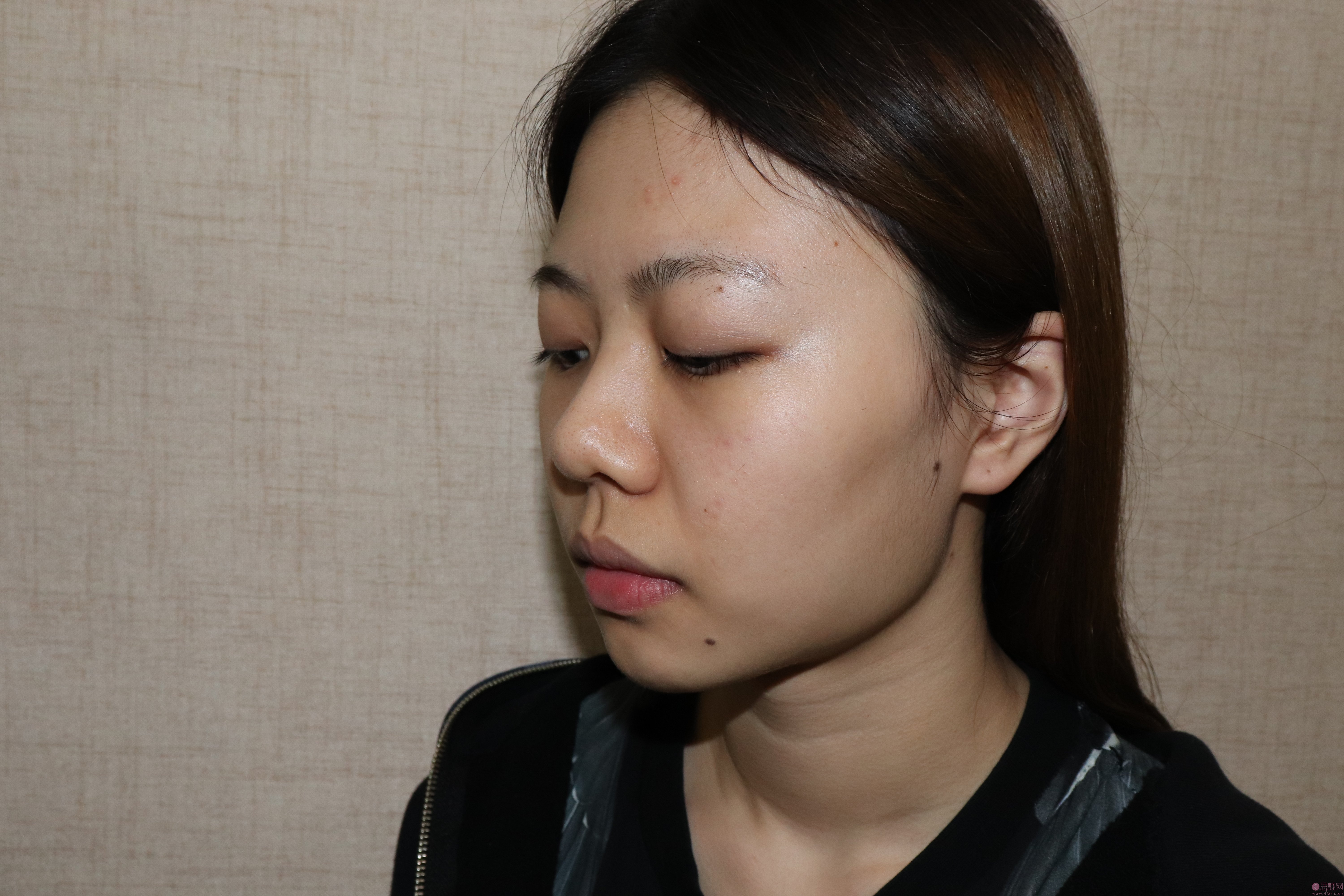 四川军大医美容整形医院隆鼻怎么样?附真人案例分享+2021年价格表曝光
