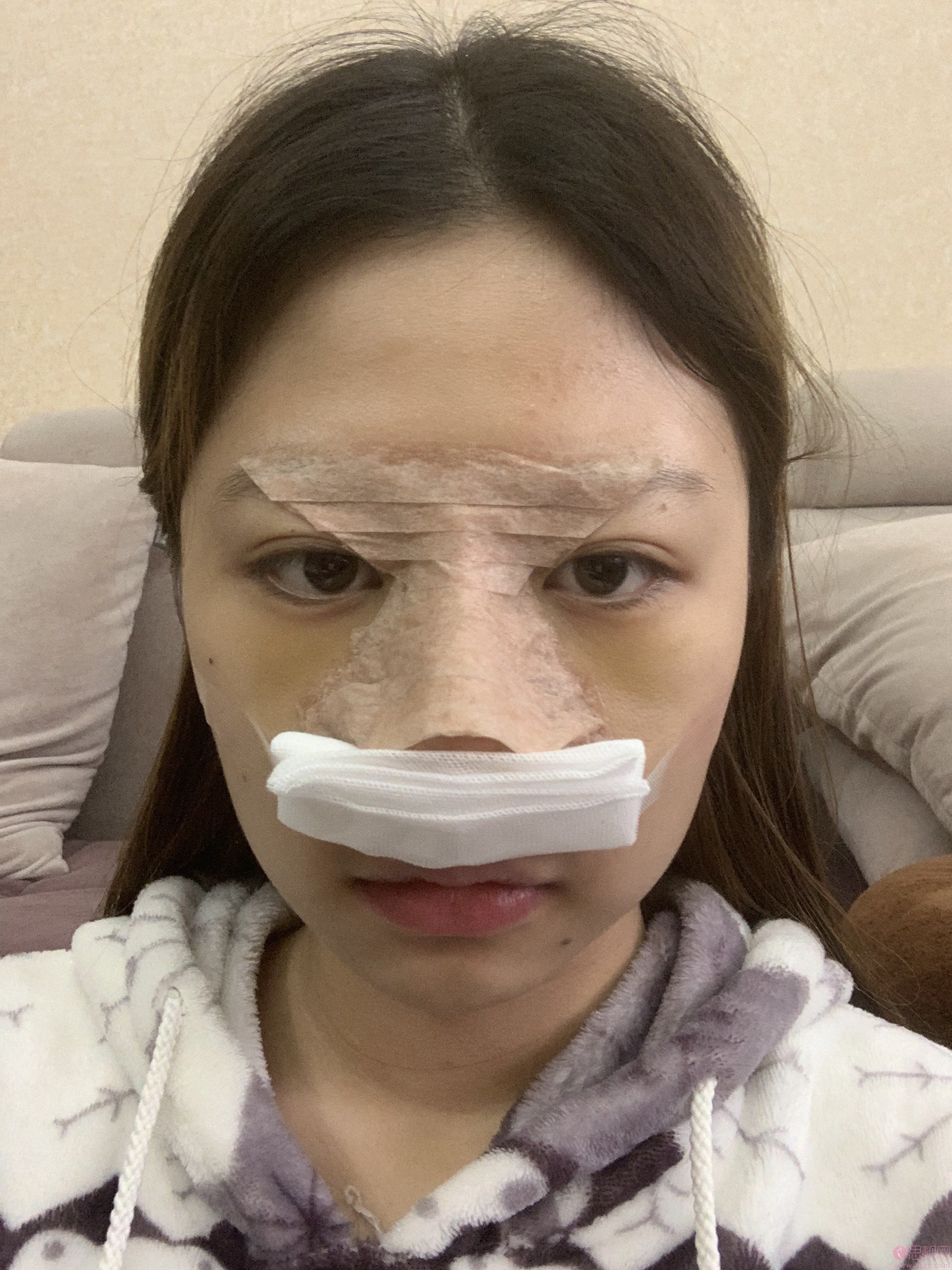 四川军大医美容整形医院隆鼻怎么样?附真人案例分享+2021年价格表曝光
