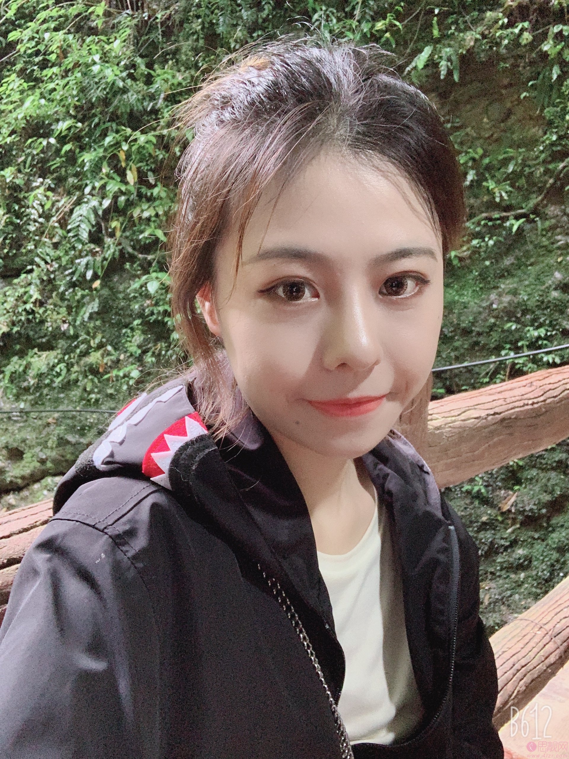 四川军大医美容整形医院隆鼻怎么样?附真人案例分享+2021年价格表曝光