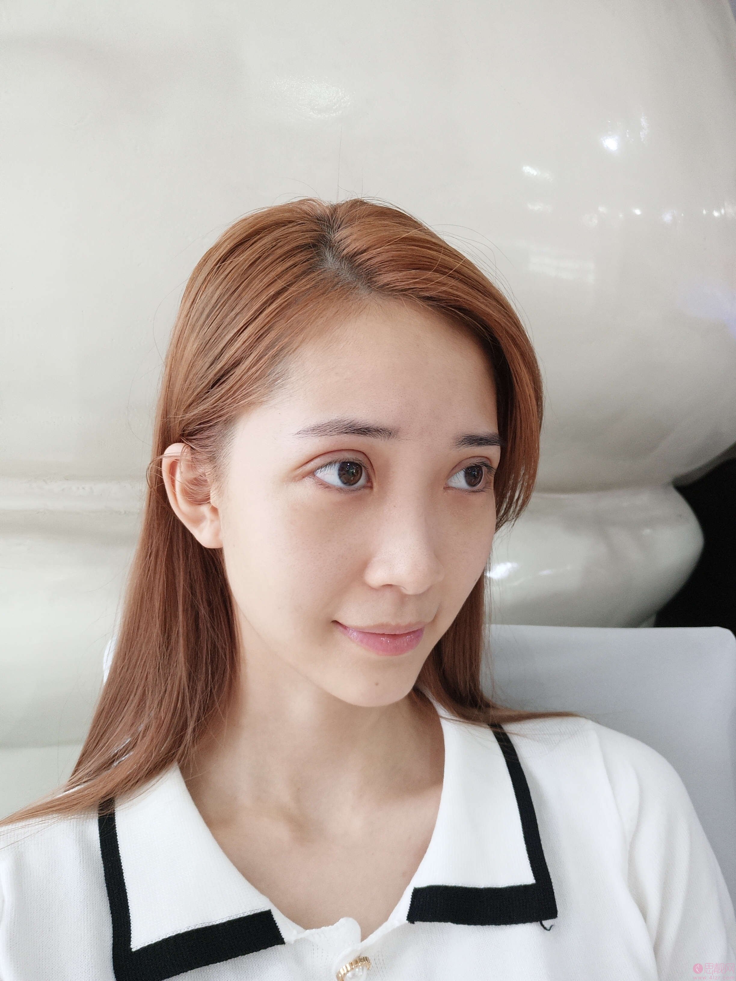 王世勇修复眼睛怎么样？附案例及2021年价格表一览