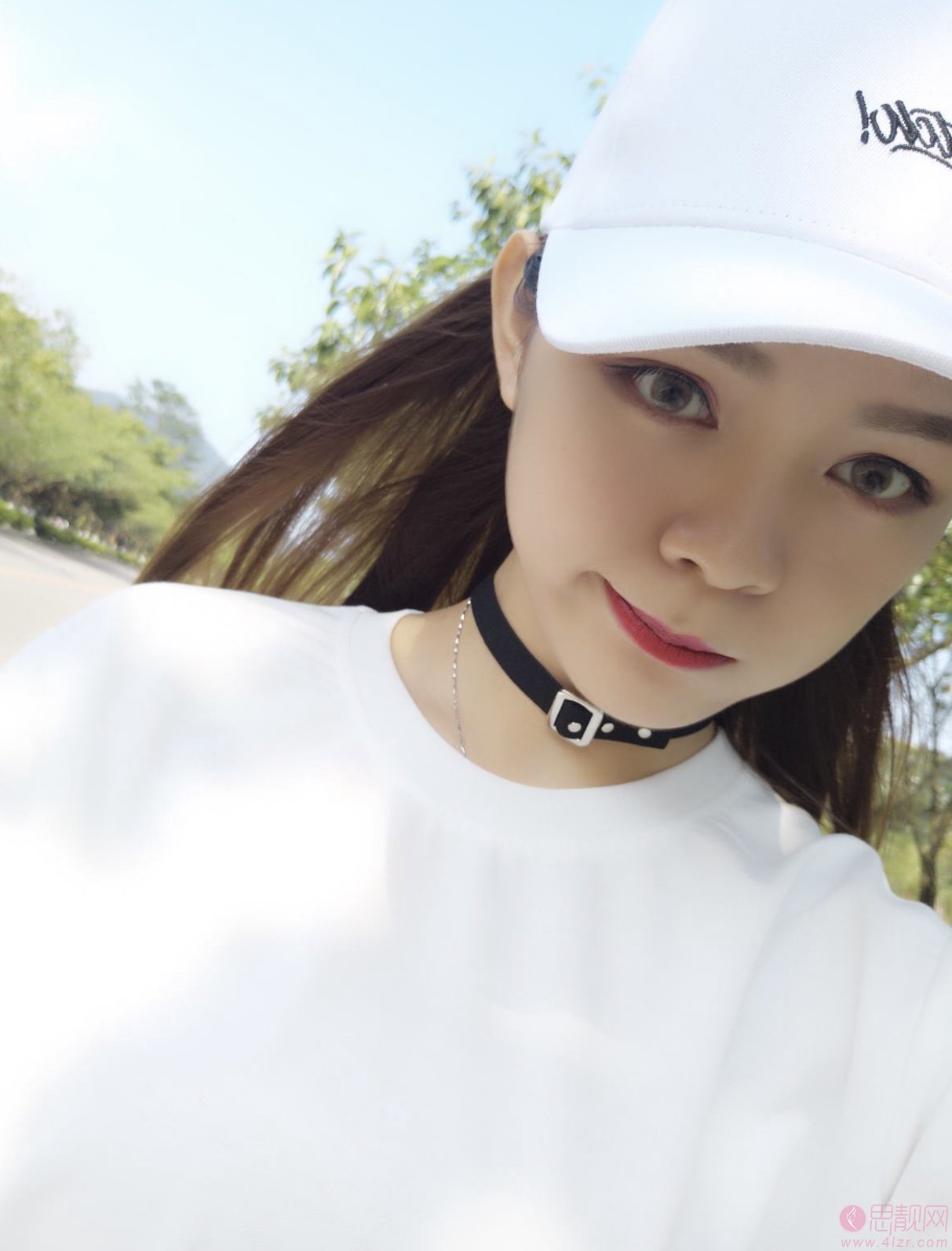 大连维恩傅晓茜医生隆鼻怎么样？附隆鼻真人案例反馈+2021年价格表公开