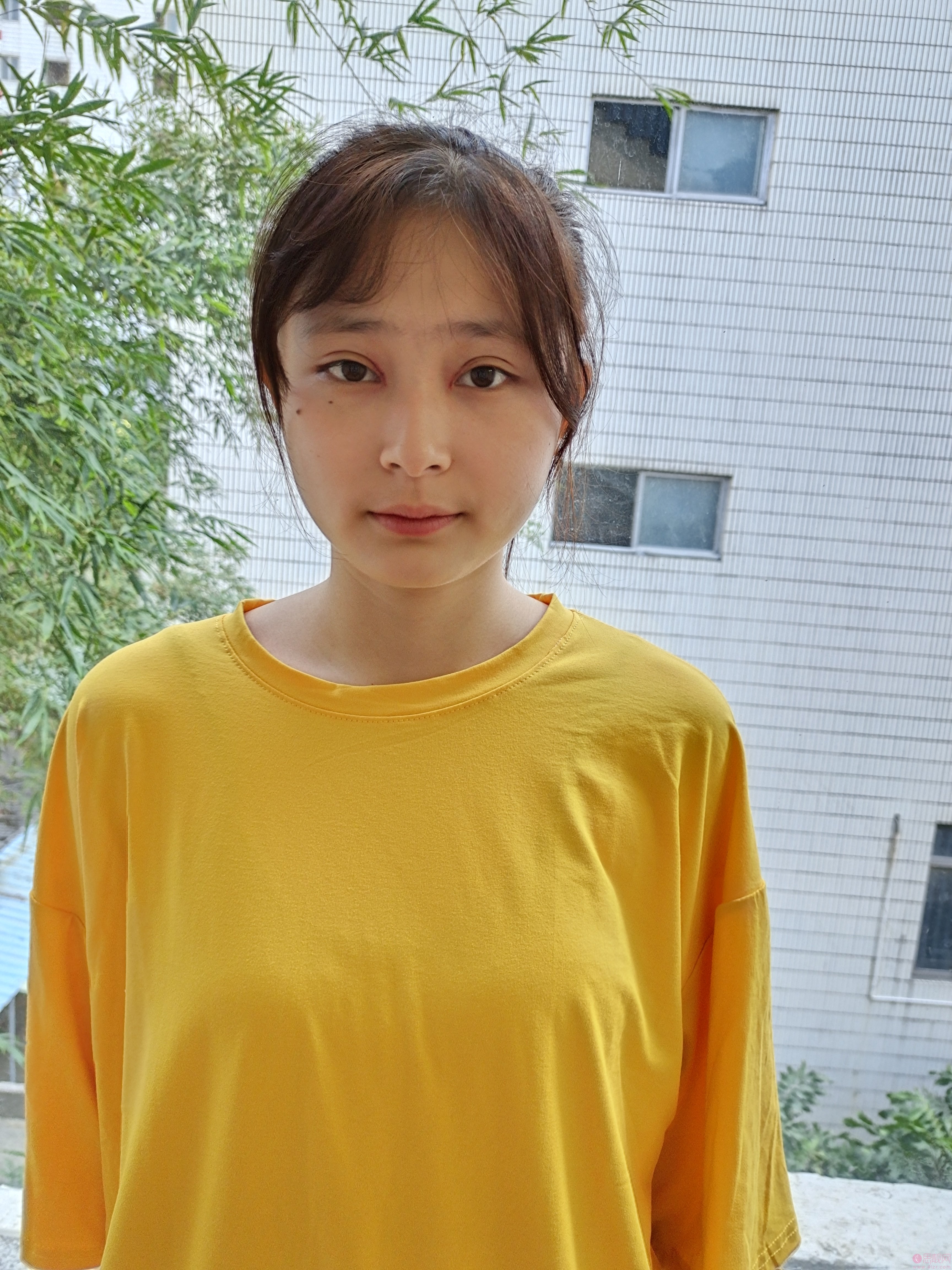 深圳希思医疗美容医院李俊医生做双眼皮怎么样？附术后效果展示+2021年价格表发布