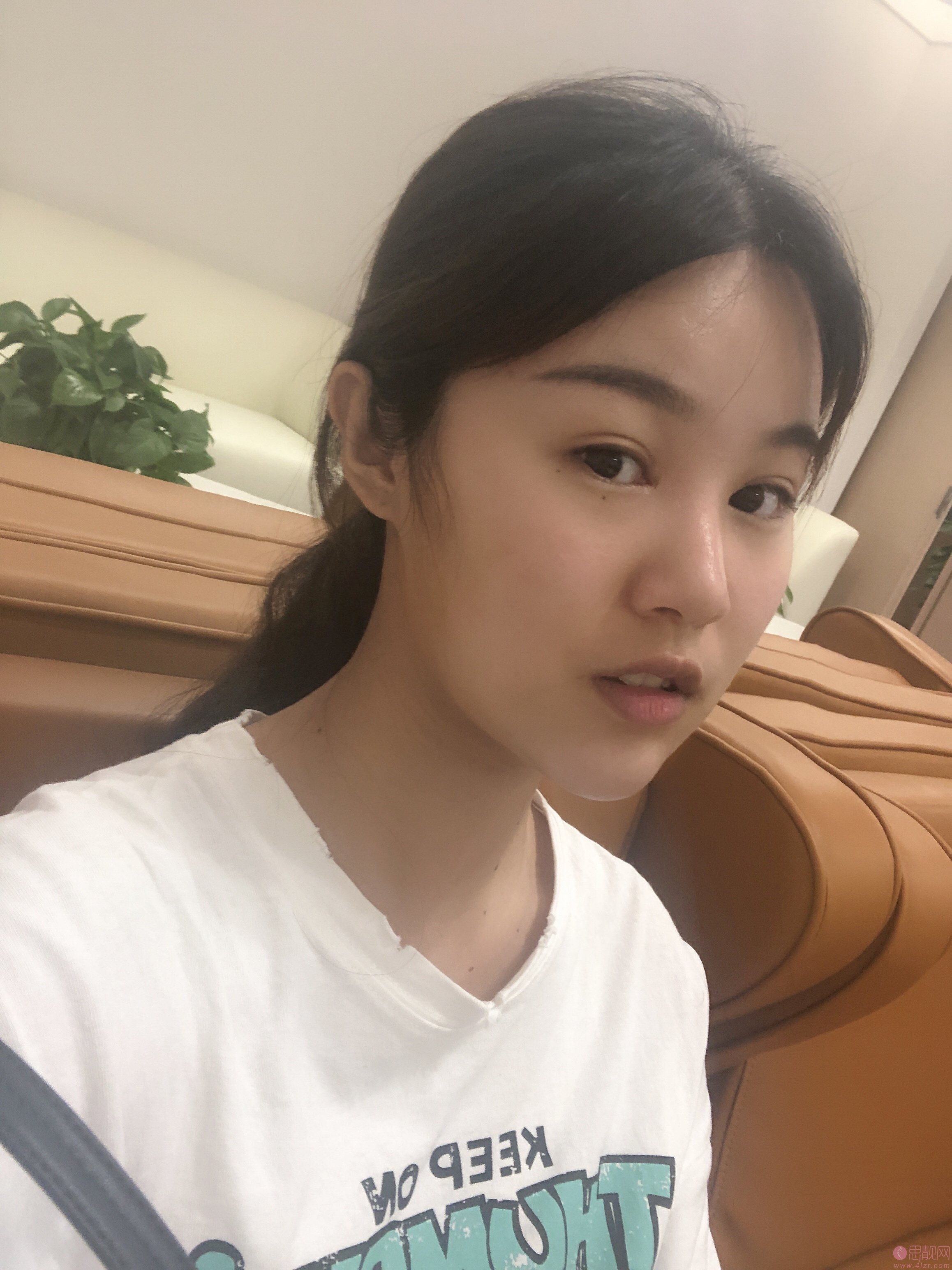 重庆珂琳雅整形医院隆鼻怎么样？附案例及2021年全新价格表公开